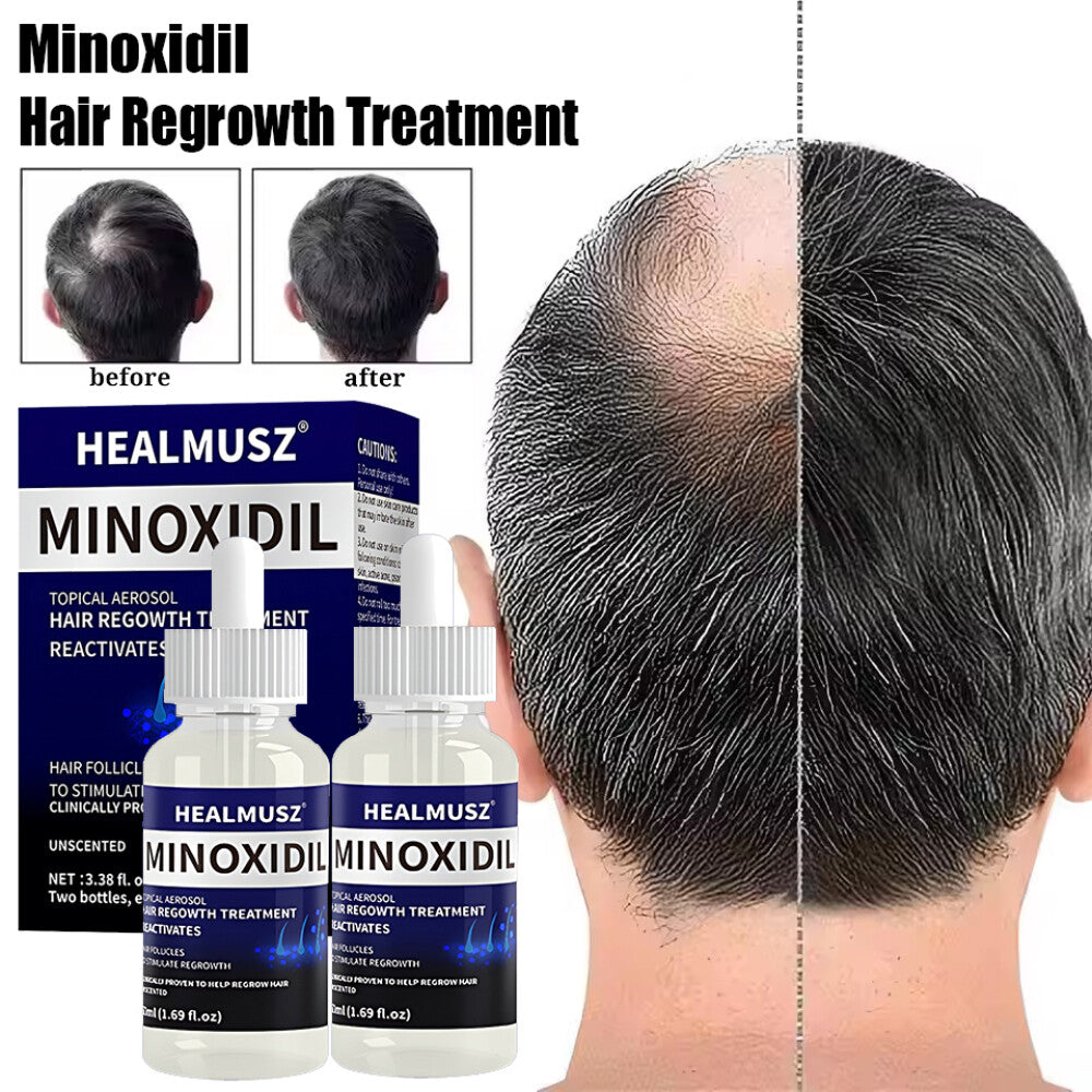 5% Minoxidil Hair Regrowth Treatment - 50ml x 2