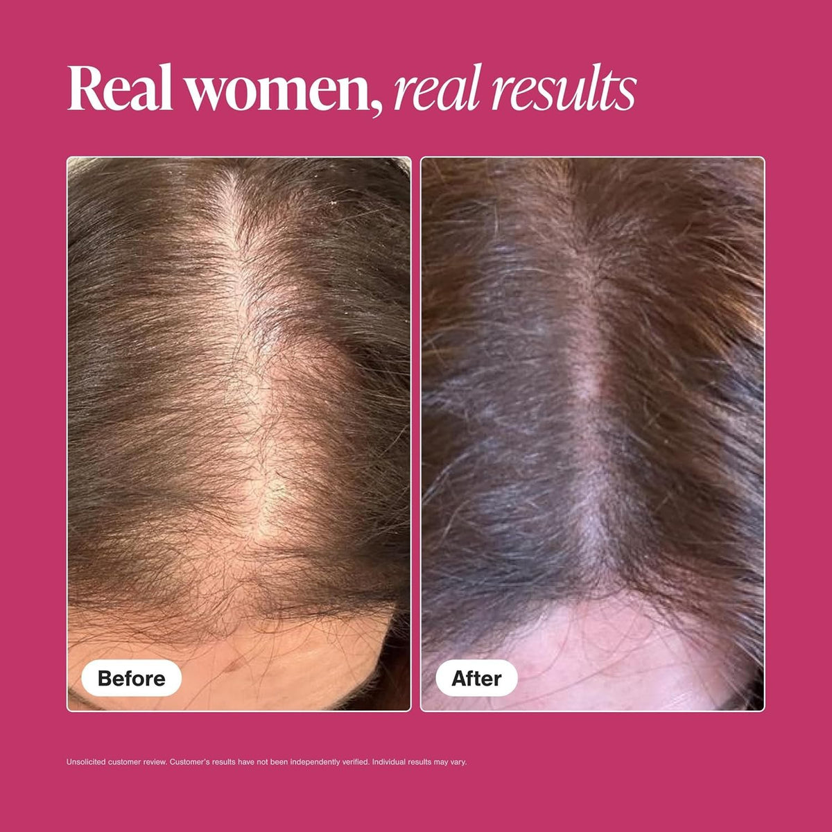 Clinically Backed Hair Growth for Women - 60 Lemon Flavor Tablets,