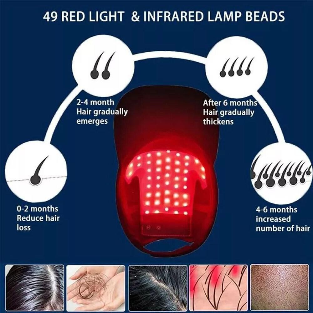 650nm Red LED Light Therapy Hat for Hair Loss Treatment & Growth