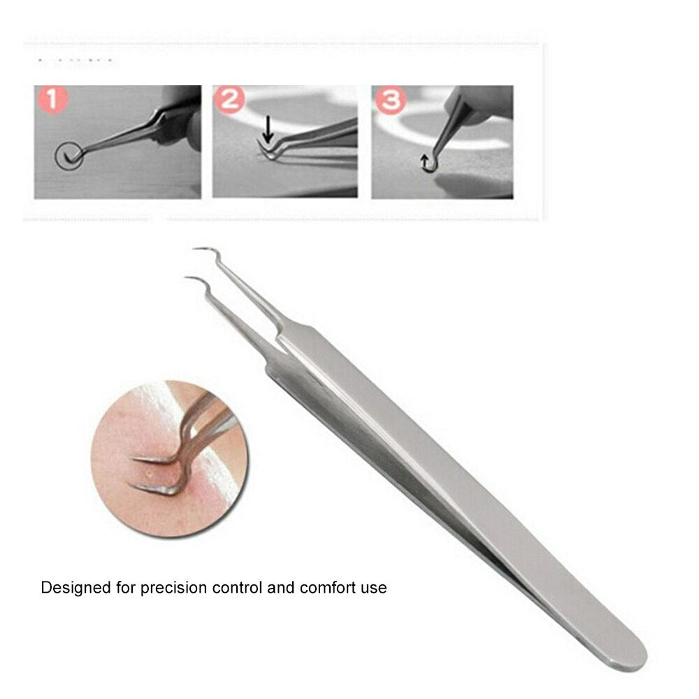 Blackhead and Acne Comedone Extractor Kit - Stainless Steel Pimple Remover with Tweezers & Case