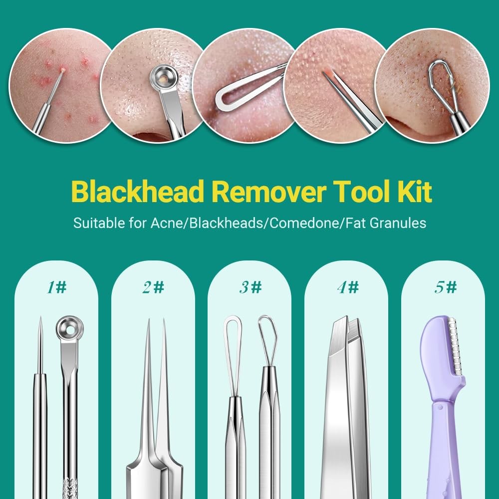 Pimple Popper Tool Kit - 6pcs Blackhead Removers & Acne Extractors, Stainless Steel