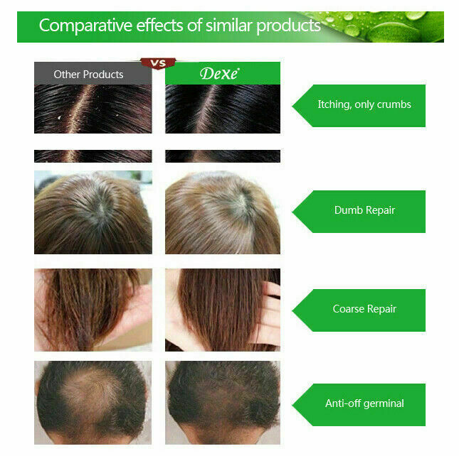 DEXE 200ml Anti-Hair Loss Shampoo Promote Hair Growth for Men & Women