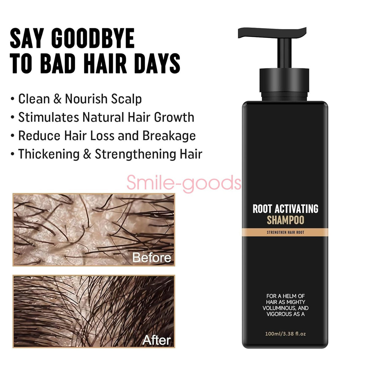 Root Activator Shampoo for Hair Loss and Hair Growth - Natural Nourishing Formula