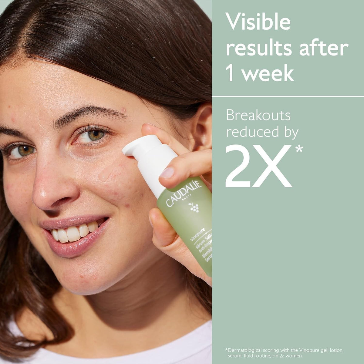 Vinopure Skin Perfecting Serum 30ml | Pore Purifying