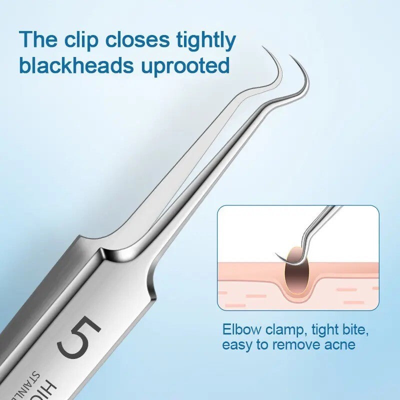 3PC Ultra-Fine Blackhead Remover Tweezer Set for Face Care - Salon Quality