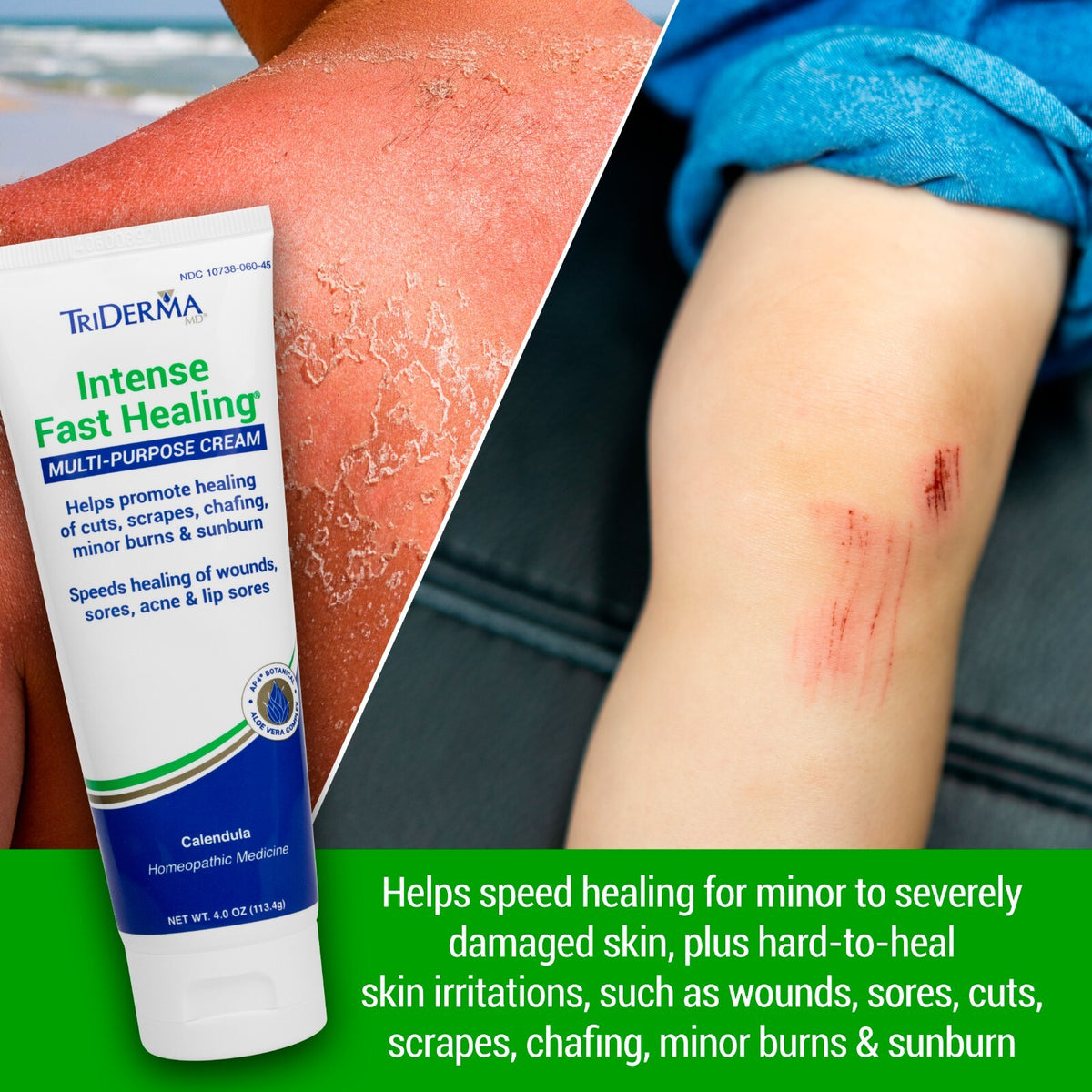 Fast Healing Cream for Face & Body - 4 oz Tube