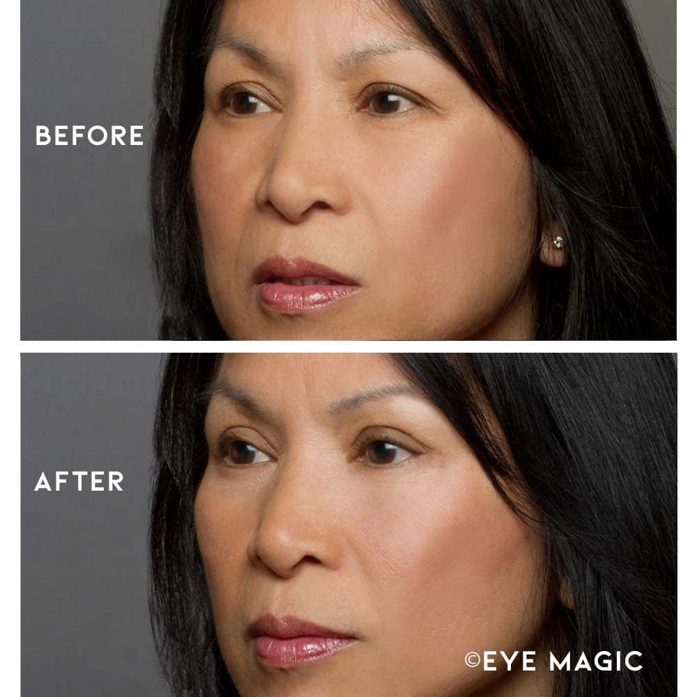 Premium Eye Lift Strips for Hooded & Droopy Eyelids - Rejuvenate & Brighten