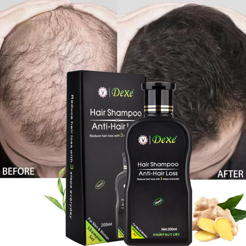 Anti-Hair Loss Shampoo for Hair Growth & Thickening - 200ml
