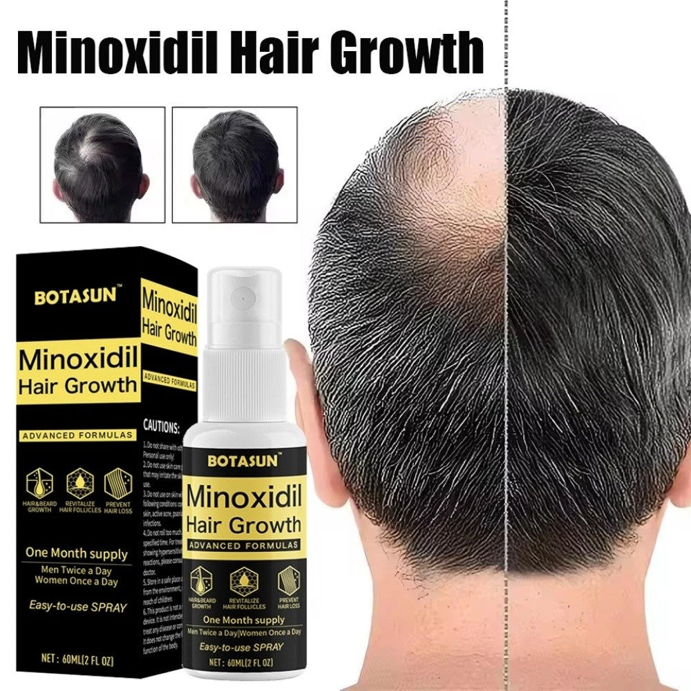 5% Minoxidil Hair Growth Serum Spray