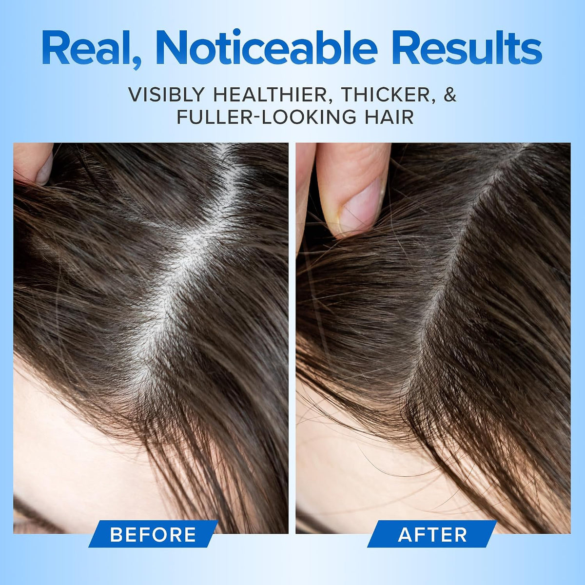 Hair Growth Shampoo Sulfate Free for Thinning Loss Men Women 16oz Aloe