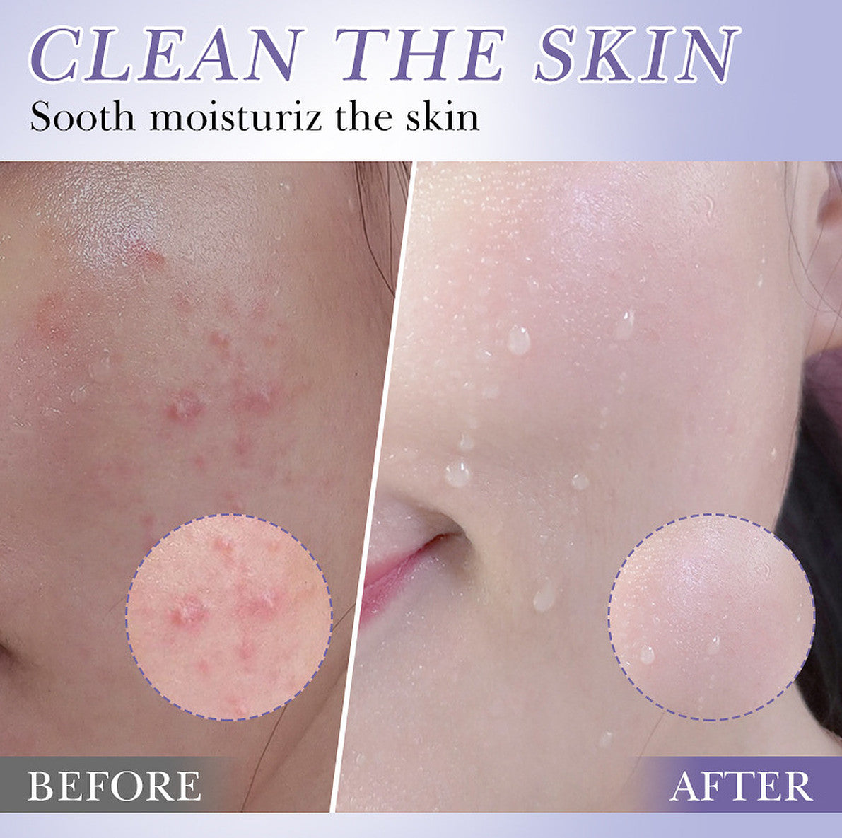Retinol Facial Cleanser with Hyaluronic Acid - 100g Anti-Aging Skin Care