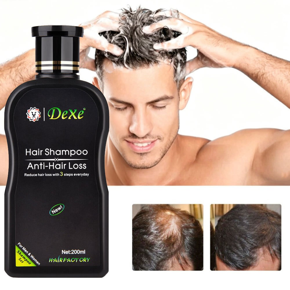 Anti Hair Loss Shampoo - 200ml Natural Herbal Treatment