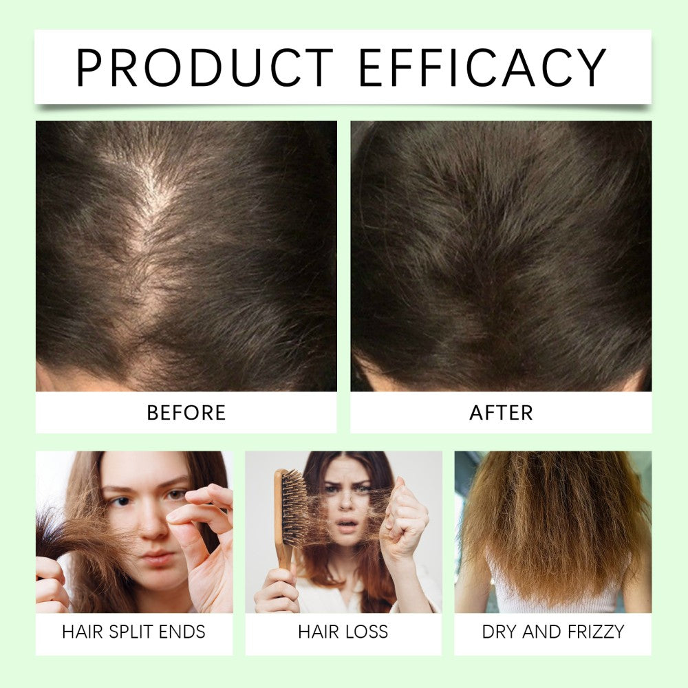 Organic Rosemary Hair Growth Shampoo for Thinning Hair & Anti-Hair Loss - 2 Pack