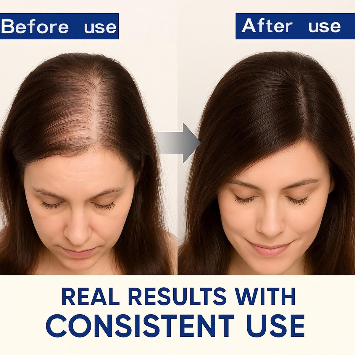 Rosemary Oil Hair Growth Serum with Biotin & Black Castor