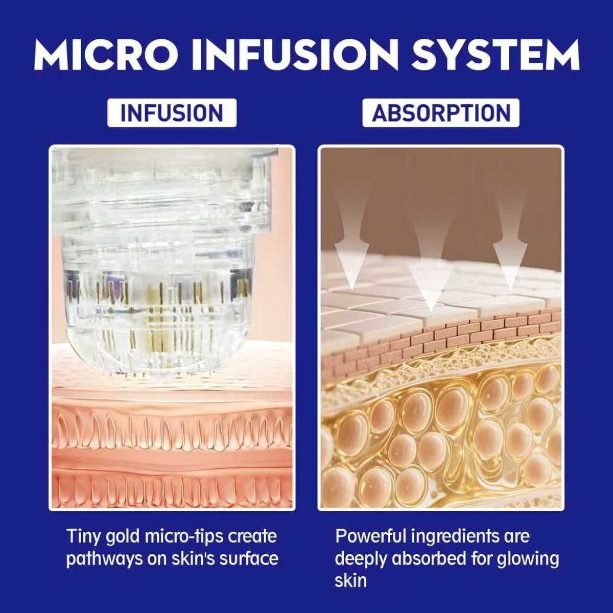 Anti-Aging Micro Infusion Device with Hyaluronic Acid Serum - 0.05mm Microneedle Skin Care System