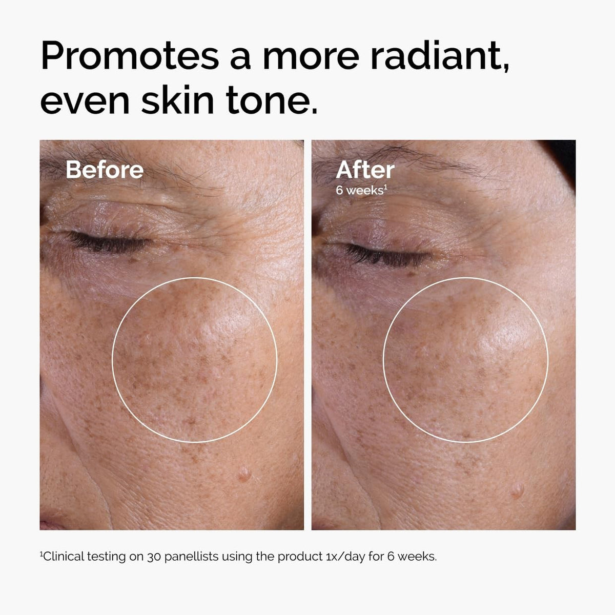 Glycolic Acid 7% Exfoliating Toner 8.11 Fl Oz Skin Brightening