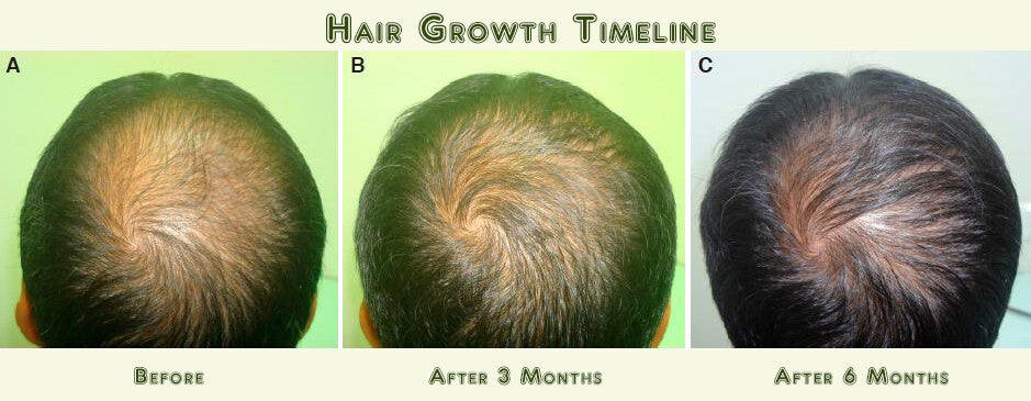 Hair Loss Regrowth Shampoo & Conditioner Set - 16 Natural Oils