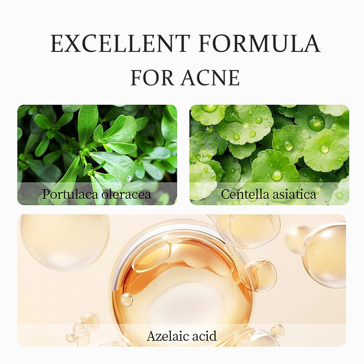 Azelaic Acid Face Cream with Hyaluronic Acid for Acne & Redness - Gentle Skin Soothing Serum