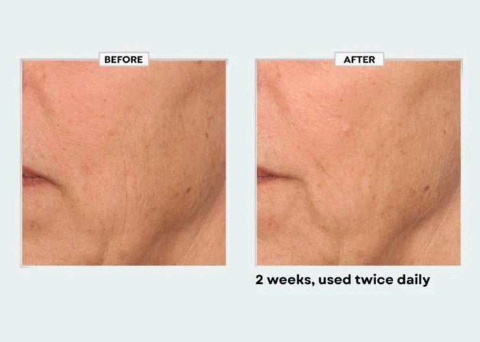 Black Rice Face Cream - Anti-Aging Moisturizer with Peptides & Antioxidants, 6.7 fl oz