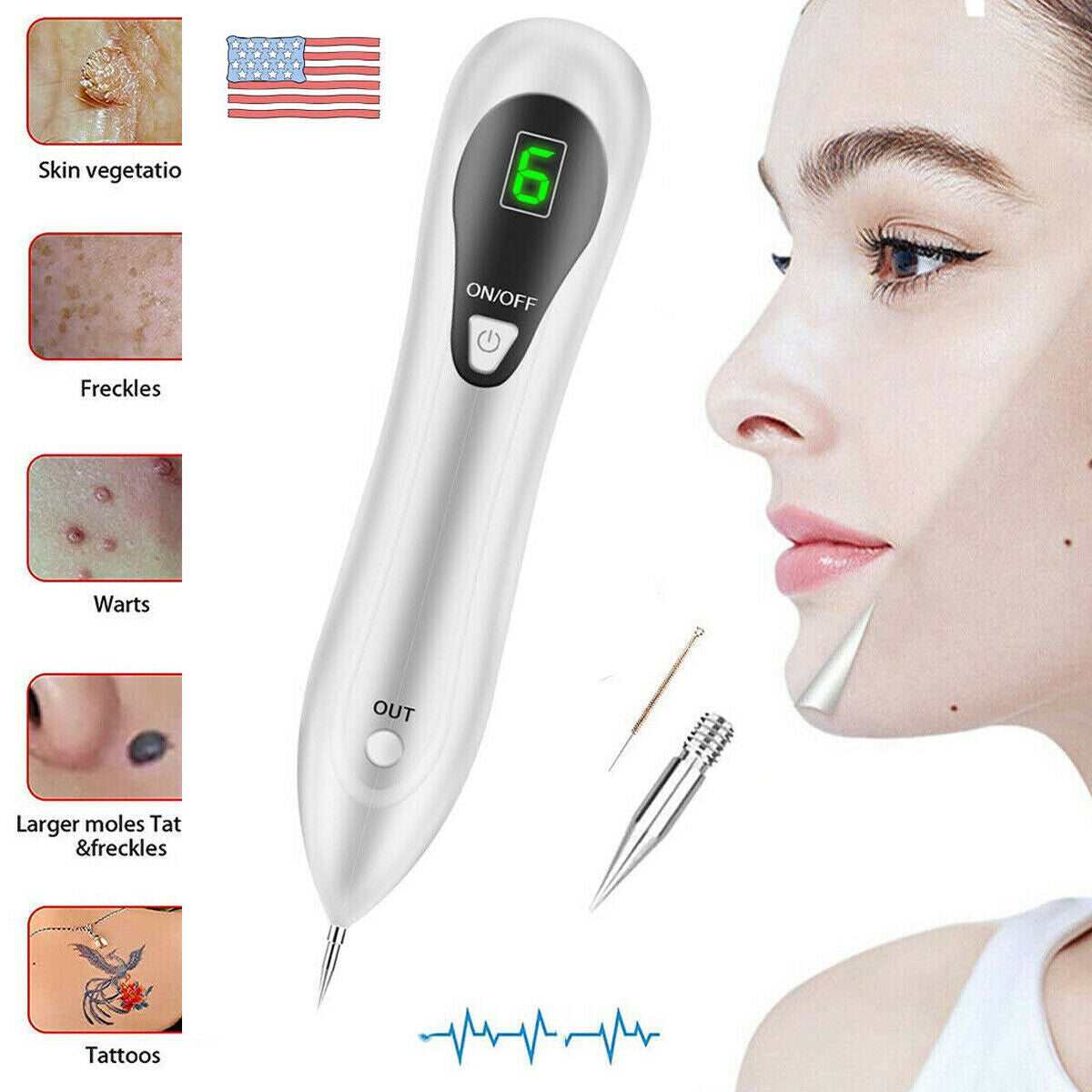 Laser Mole & Skin Tag Removal Pen - Dark Spot & Wart Remover, Rechargeable
