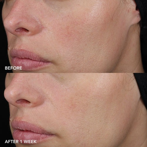 Skin Barrier Repair Balm for Sensitive and Irritated Skin - 57g 2oz