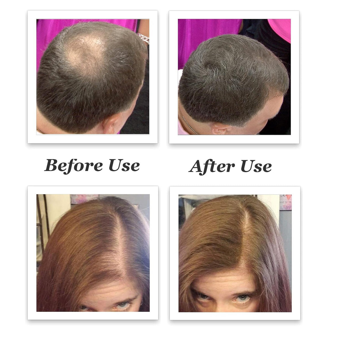 Hair Building Fibers Medium Brown 27.5g