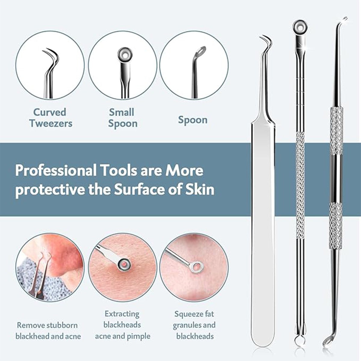 Blackhead & Pimple Comedone Extractor Kit - 9 Professional Skin Care Tools