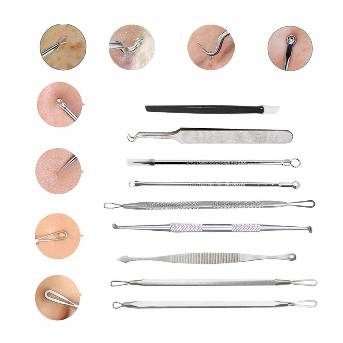 Blackhead Remover Tool Kit - Pimple Acne Extractor with Stainless Steel Needles