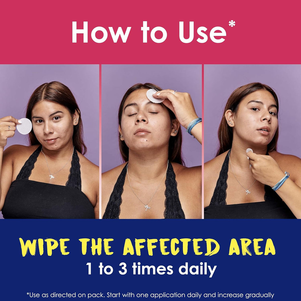 Deep Acne Treatment Pads with 2% Salicylic Acid for Fast Pimple Relief