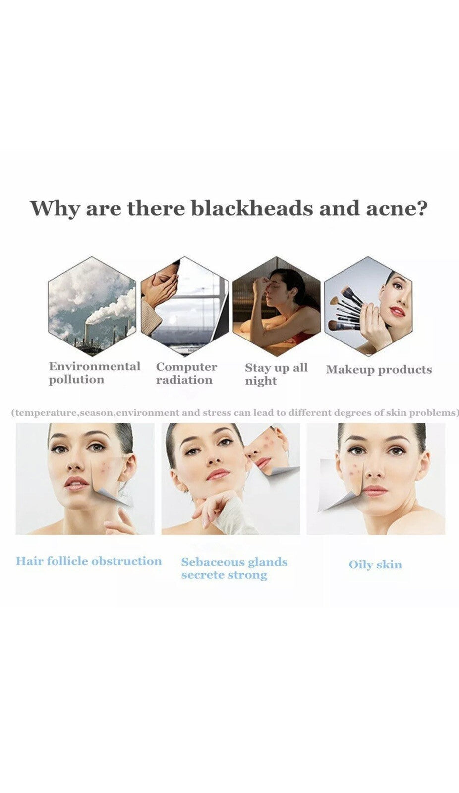 Blackhead Acne Removal Tool Kit with Pimple Extractors and Cotton Pads