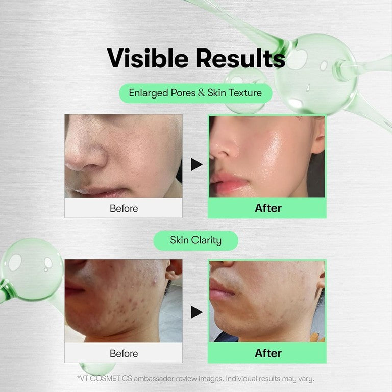 CICA Reedle Shot 100 Microneedling Serum Kit - 60ml & 30ml