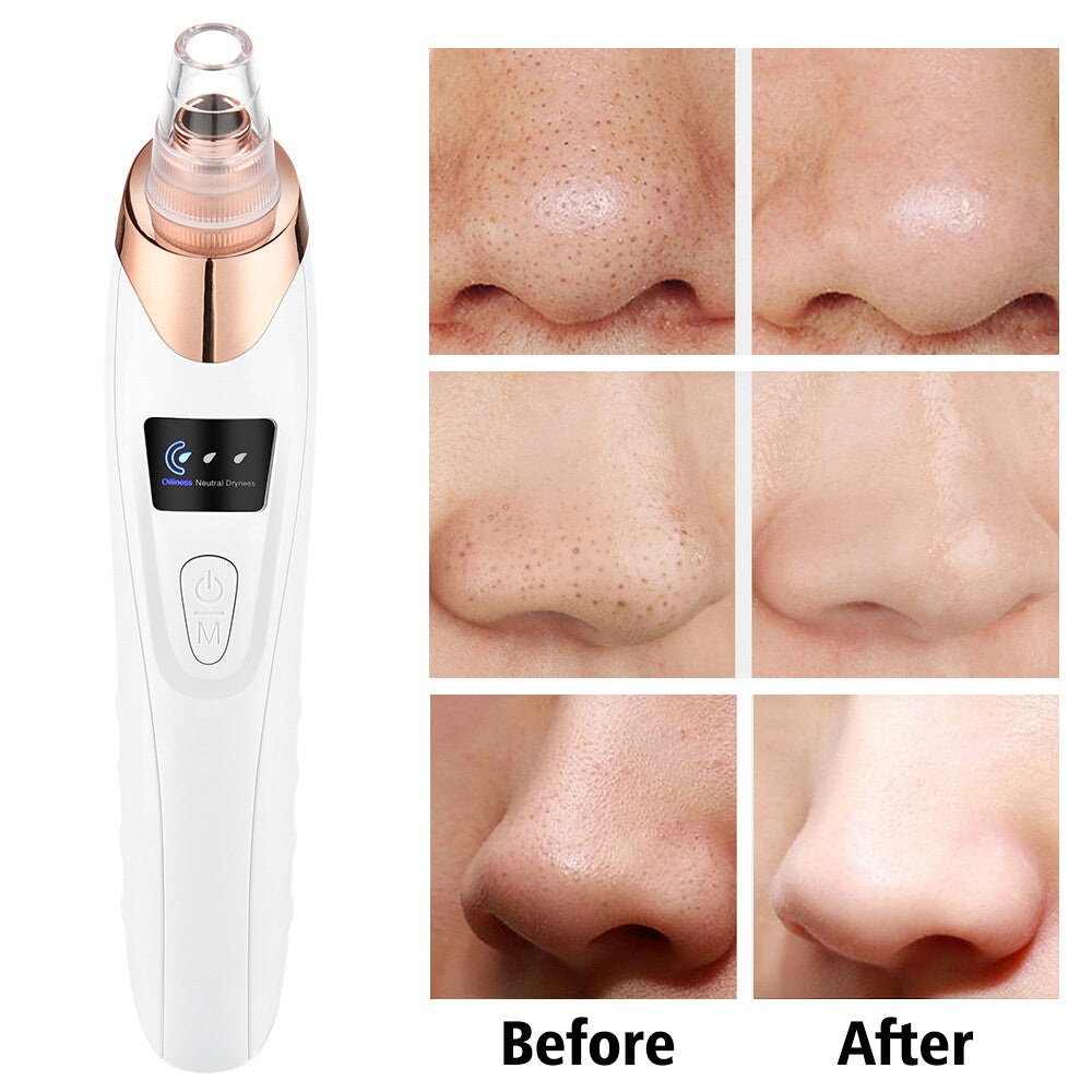 Electric Blackhead Vacuum Pore Cleaner Kit - USB Rechargeable Facial Tool
