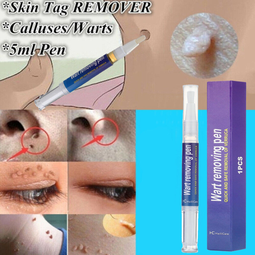 Wart & Skin Tag Remover Pen - Painless, Pimple & Mole Removal Device