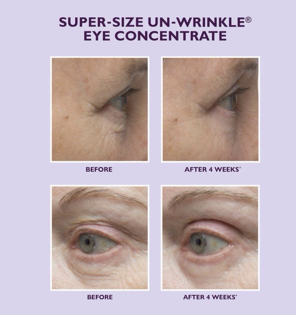 Un-Wrinkle Eye Concentrate - 1 Fl Oz Anti-Aging Eye Treatment