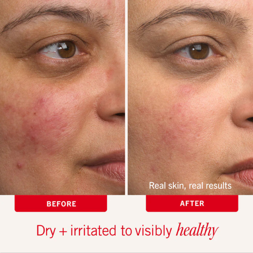Ultra Repair Cream Intense Hydration 6oz