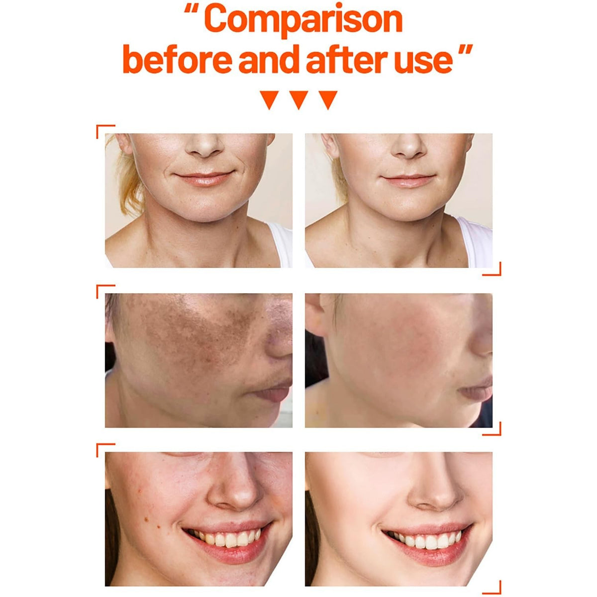 Vitamin C Skin Care Set with Orange Extract - Travel Kit, Brightening & Hydrating - 4 Pieces