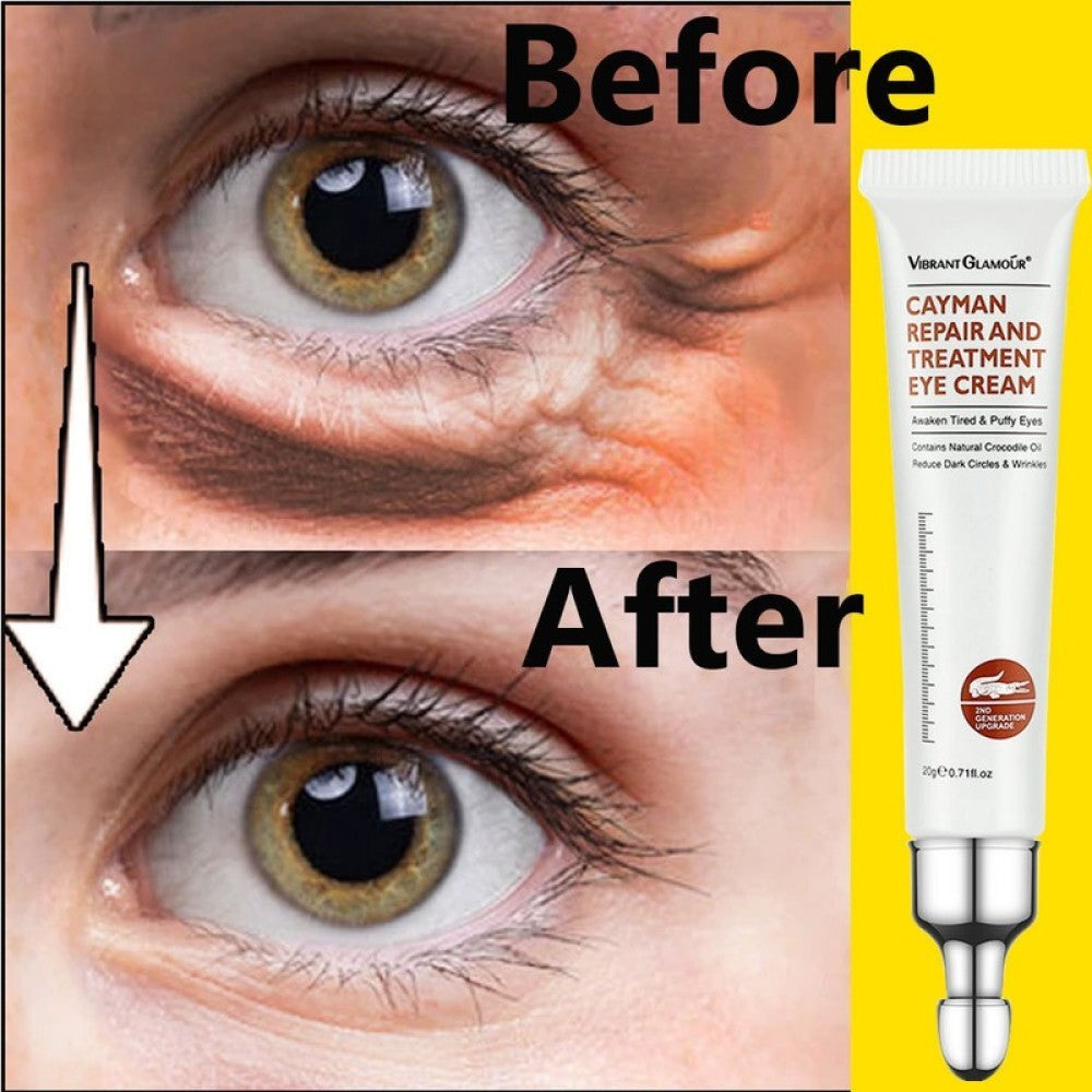 Anti-Aging Eye Cream Gel for Dark Circles & Bags - Brightening & Firming
