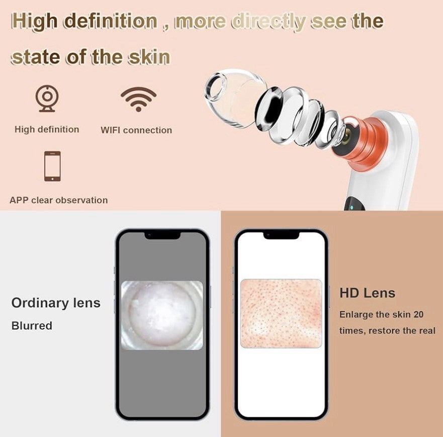 Blackhead Remover Vacuum with HD Camera & App, Rechargeable, 4 Probes