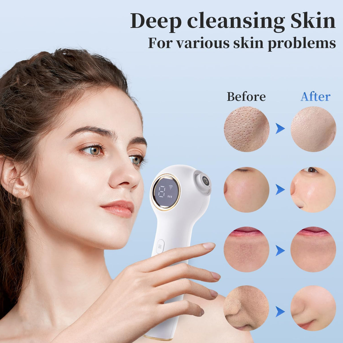 Blackhead Extractor with Camera - Pore Vacuum Remover for Face & Skin Care