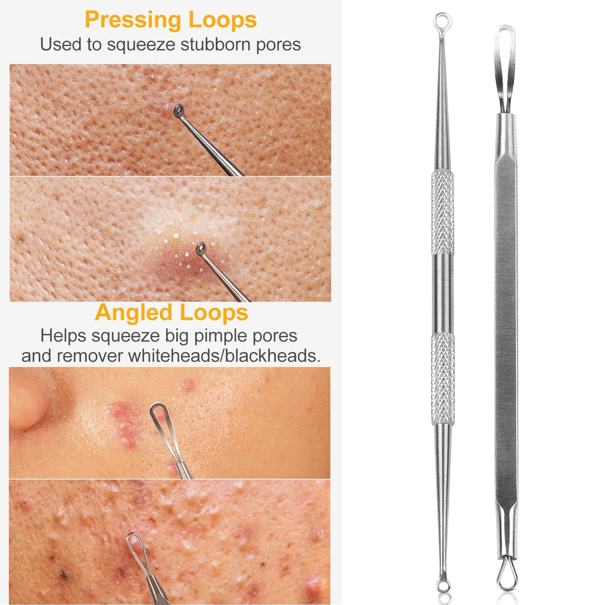 Blackhead Remover Kit 5 Pcs Facial Pimple Extractor Tools Set