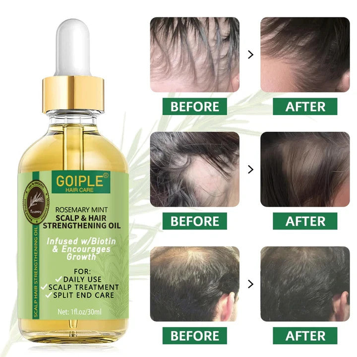 Chebe Oil for Hair Growth - Rosemary Mint Scalp Treatment Duo