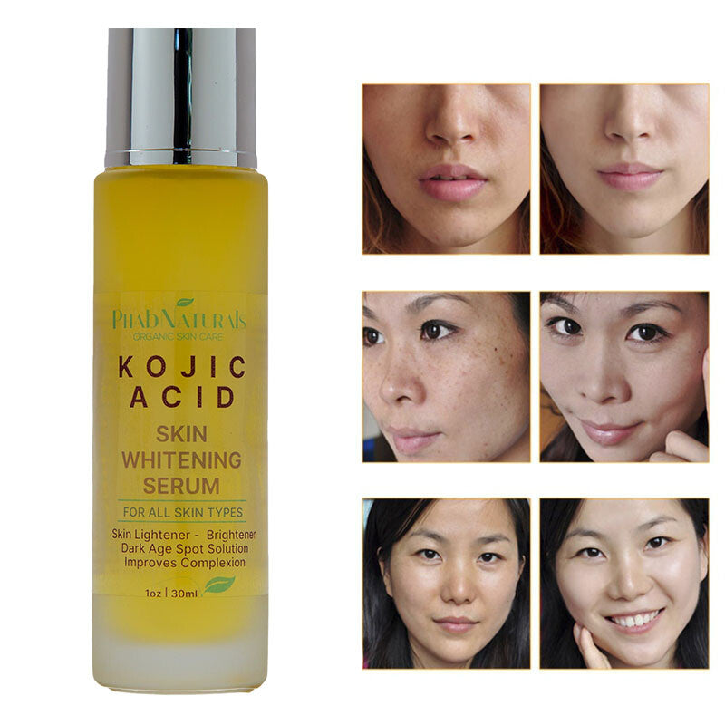 Kojic Acid Skin Whitening Serum for Brightening & Dark Spot Fade - Natural & Safe