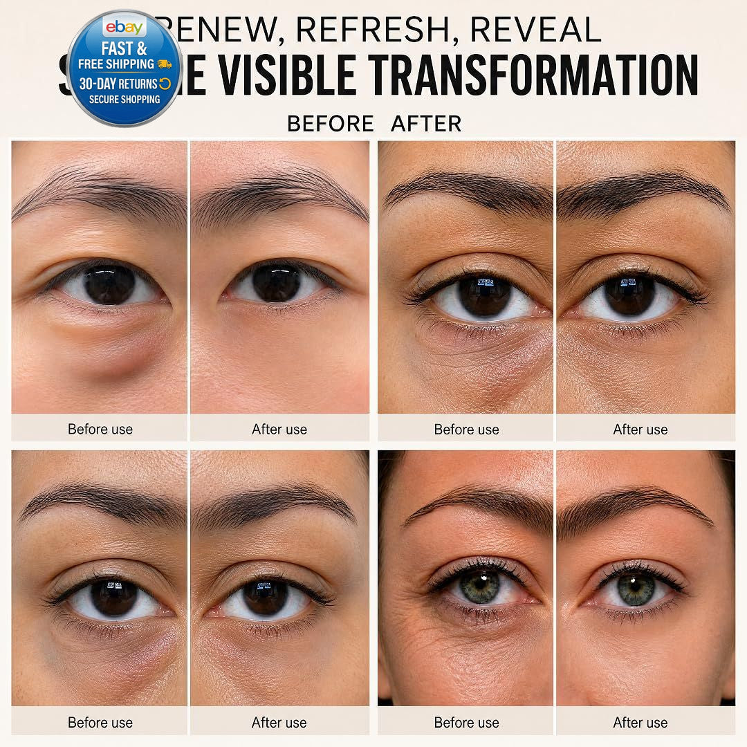 Under Eye Patches with PDRN, Calcium & Bio-Collagen - Brightening & Firming
