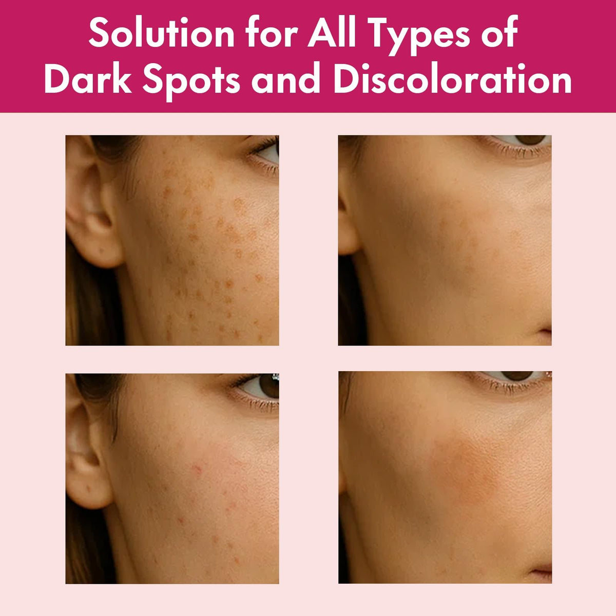 Arbutin 7% and Tranexamic Acid Face Cream for Dark Spots - 1.76 oz