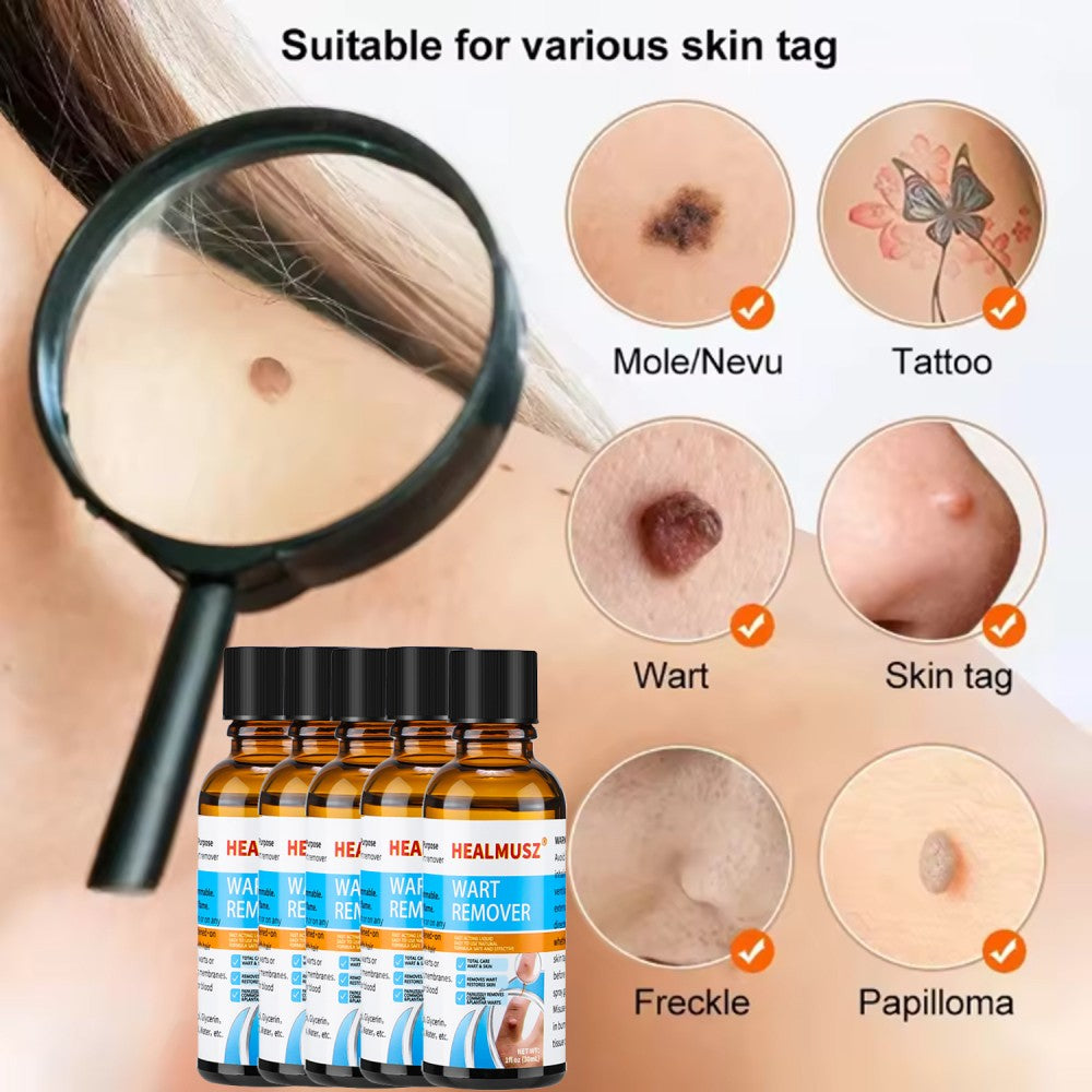 Natural Wart & Skin Tag Remover Liquid - Deep Penetration Formula, 30ml