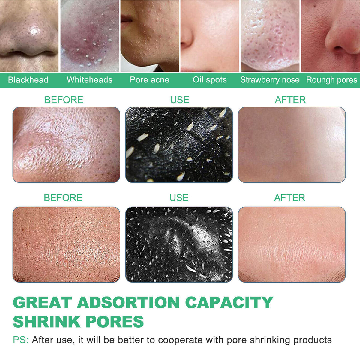 Charcoal Peel Off Mask - Blackhead & Acne Remover