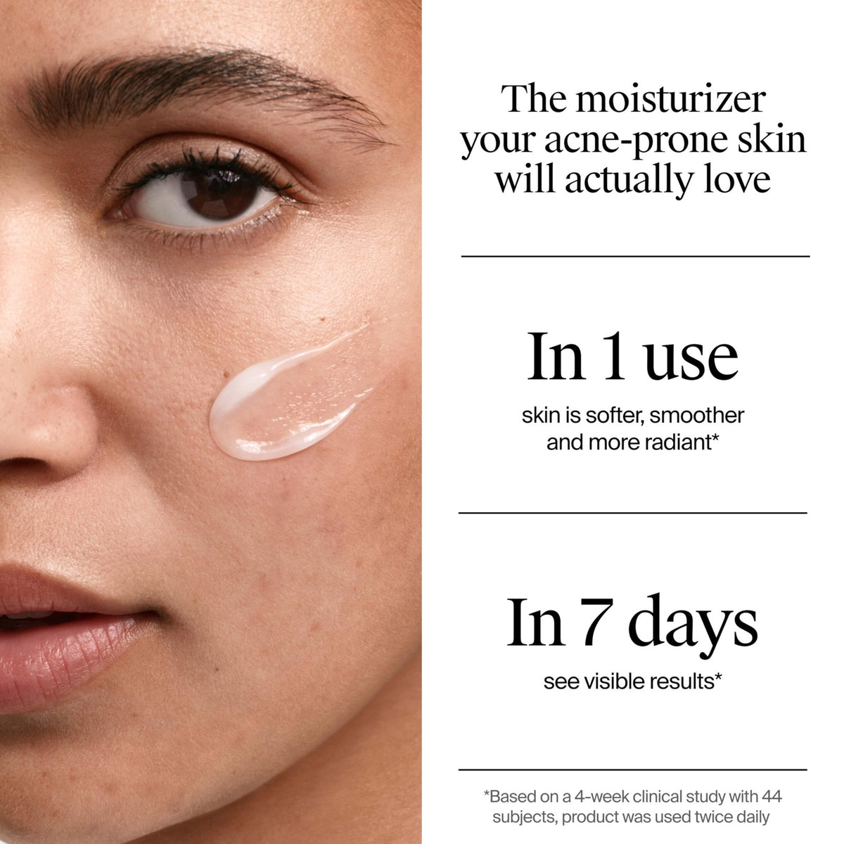 Neutrogena Acne Gel Moisturizer with Salicylic Acid & Post-Acne Fade 1.7oz