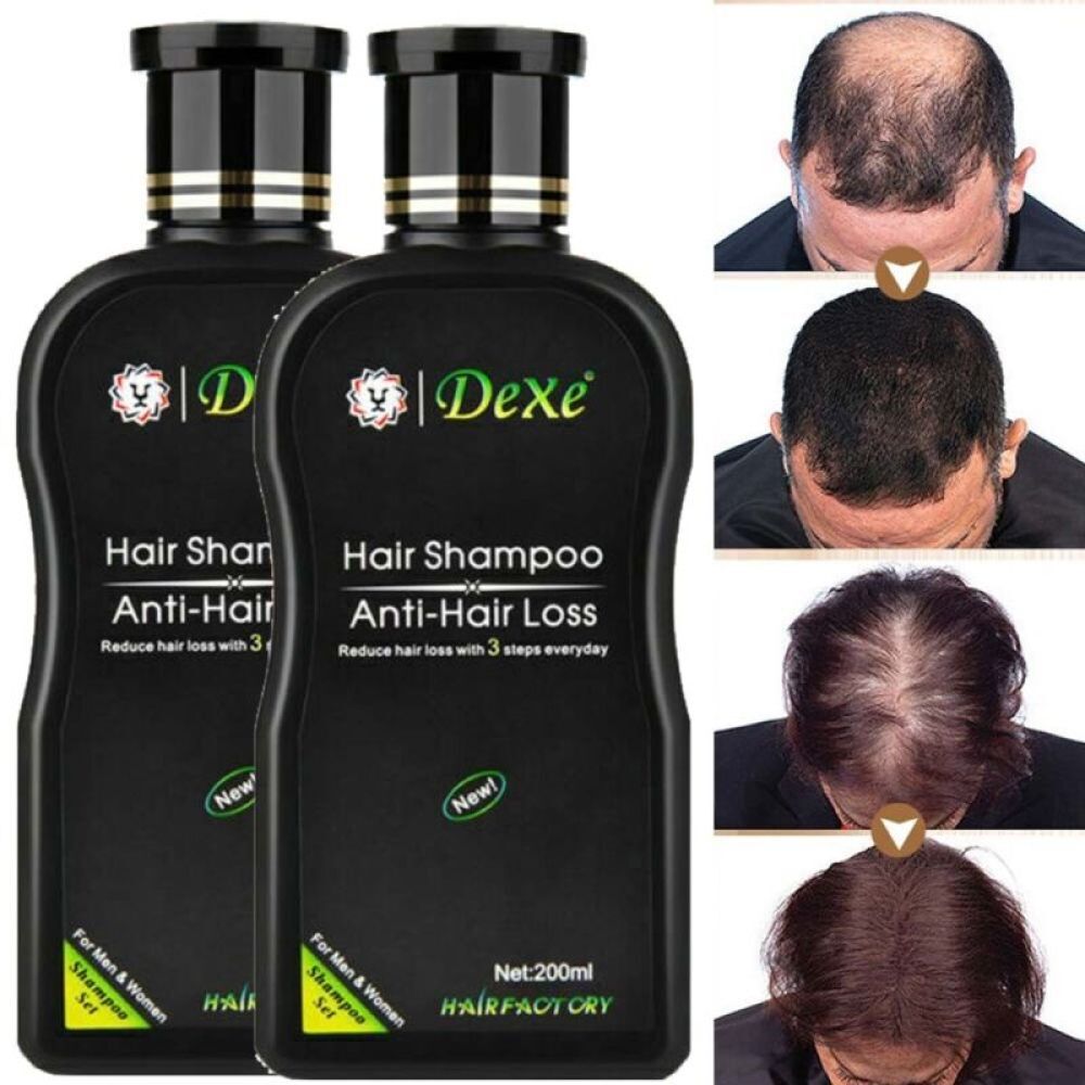 200ml Dexe Anti Hair Loss Shampoo Natural Herbal Growth Treatment