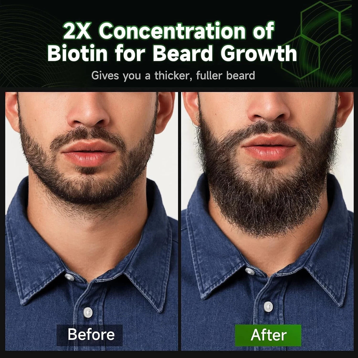Biotin Beard Growth Oil with Sandalwood - Natural Nourishing Hair Treatment, 2 oz