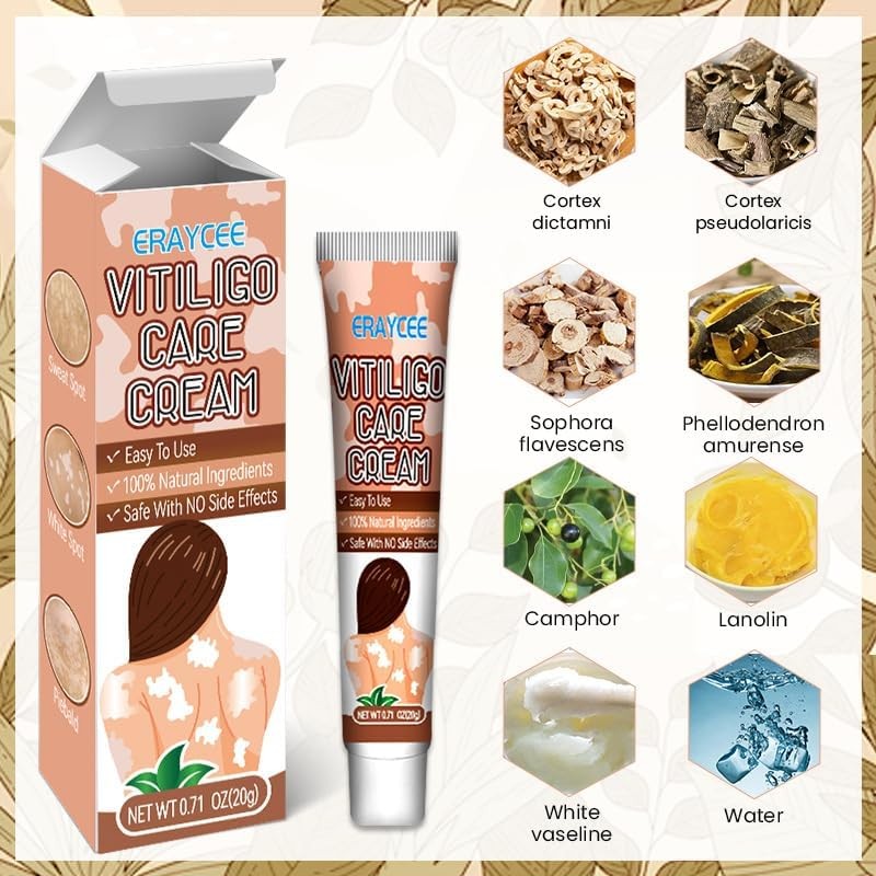 Vitiligo Cream Natural Skin Pigmentation Treatment for White Spots - Safe & Effective